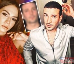 Oğuzhan Koç ‘jawline dolgusu’ yaptırdı!