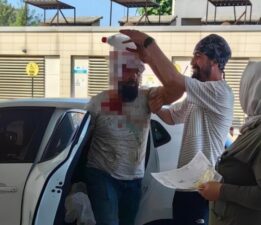 462 acemi kasap kendini yaraladı