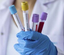 Fransa’da Covid-19’un yeni varyantı Eris yayılıyor