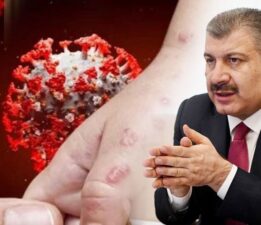 Eris varyantı Türkiye’de