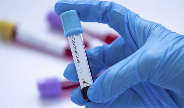 ‘Covid-19’ uyarısı: ‘Kış döneminde yaygın ve baskın olacak’